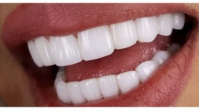 کامپوزیت دندان و لمینت؛ انتخابی برای زیبایی و استحکام 1 hjhk