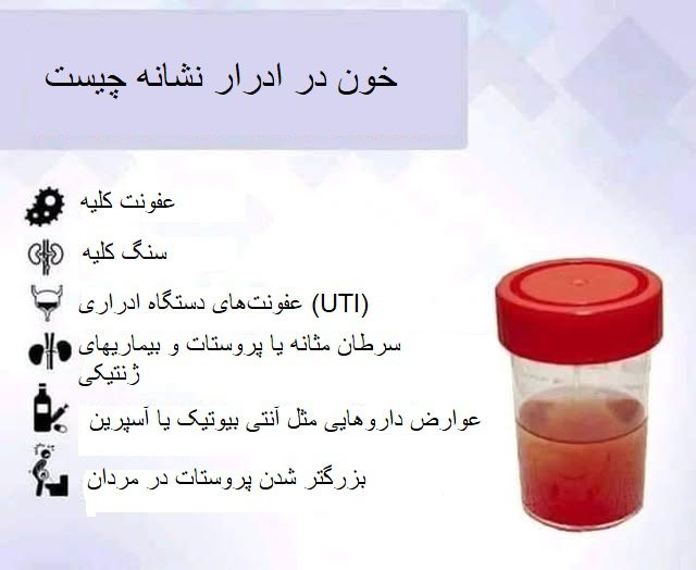علت خون در ادرار زنان نشانه چیست
