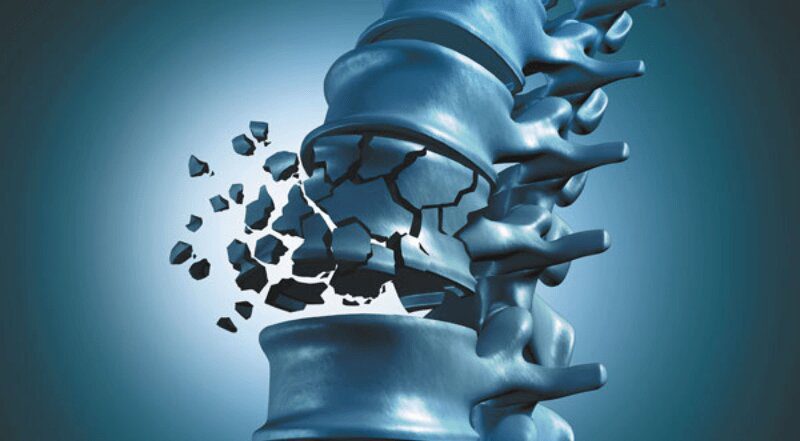 میوهای که استخوانهایتان را از پوک شدن نجات میدهد 1 میوهای که استخوانهایتان را از پوک شدن نجات میدهد