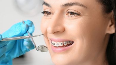 انواع روش های ارتودنسی