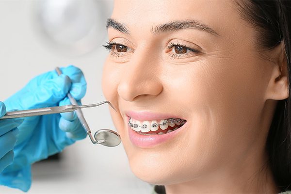 راهنمای کامل انواع روشهای ارتودنسی: از ثابت و متحرک تا اینویزیلاین 1 انواع روش های ارتودنسی