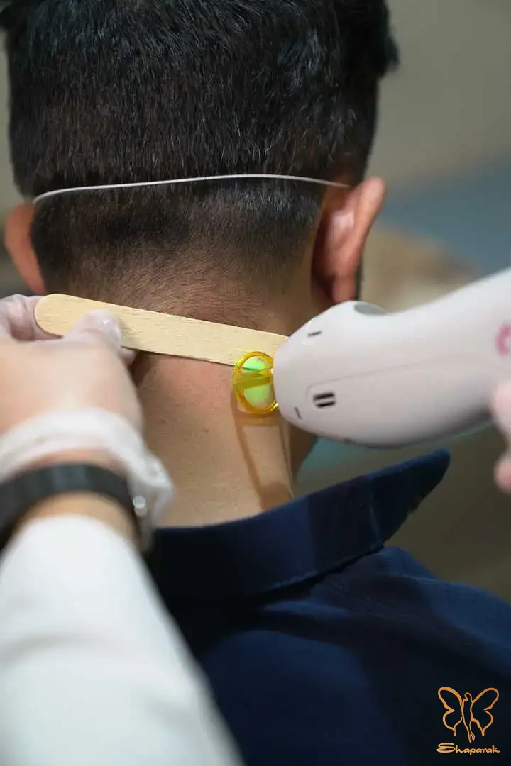 آیا لیزر مو زائد بیکینی و زیر بغل عوارض دارد؟ پاسخ صادقانه این سوال واقعا چیست؟ 3 654512366o 1j91ri08j1ajpfk01l671ck2ok1c .webp