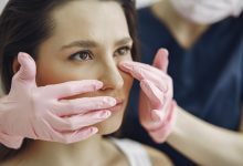 مراقبت های بعد از رینوپلاستی